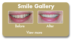 Smile Gallery